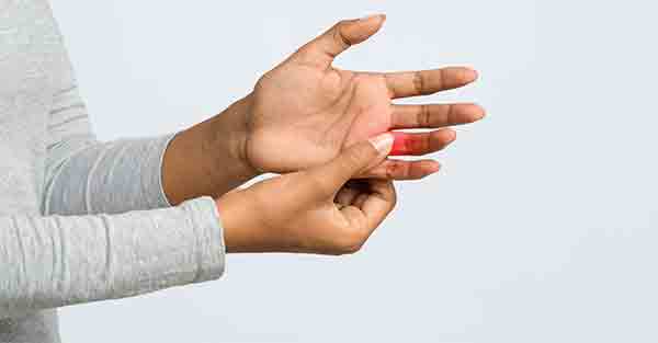 Arthritis: The Misunderstood Diagnosis